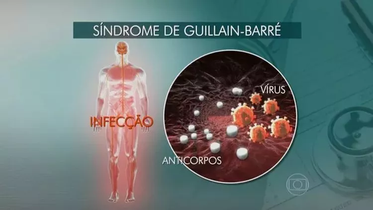 Peru declara emergência de saúde por surto de síndrome de Guillain Barré